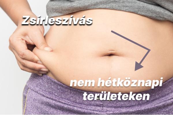 Zsírleszívás: nem hétköznapi területek és a beavatkozás korlátai