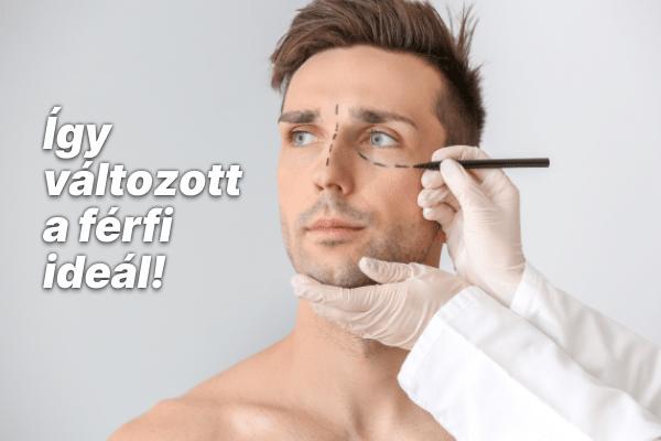 Lumberjacktől Kenig – Így változott a férfi ideál