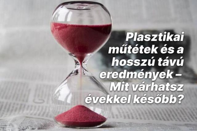 Plasztikai műtétek és a hosszú távú eredmények – Mit várhatsz évekkel később?