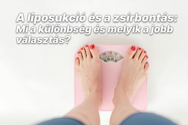 A liposukció és a zsírbontás: Mi a különbség és melyik a jobb választás?