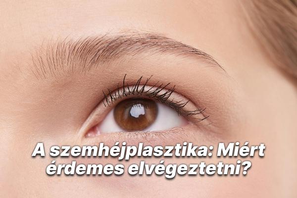 A szemhéjplasztika: Miért érdemes elvégeztetni?