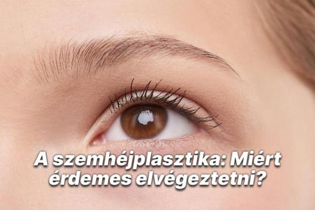 A szemhéjplasztika: Miért érdemes elvégeztetni?