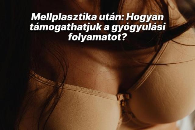 Mellplasztika után: Hogyan támogathatjuk a gyógyulási folyamatot?