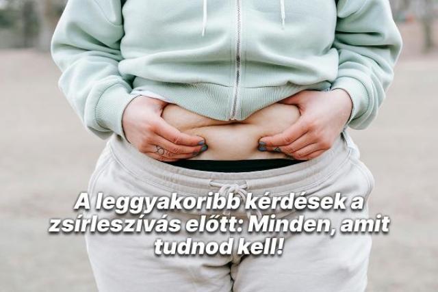 A leggyakoribb kérdések a zsírleszívás előtt: Minden, amit tudnod kell!