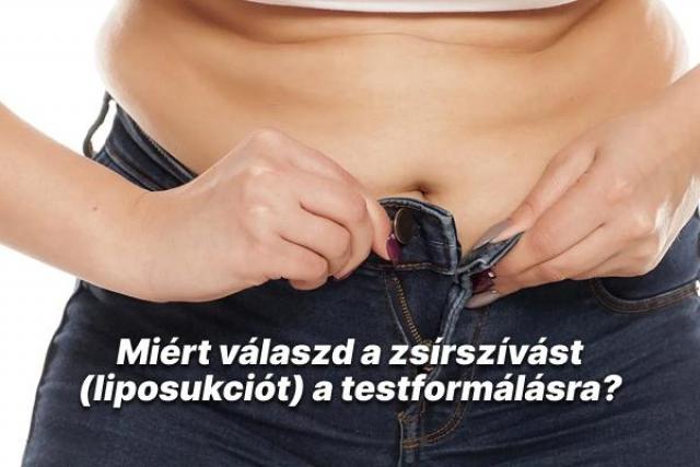 topforma-blog