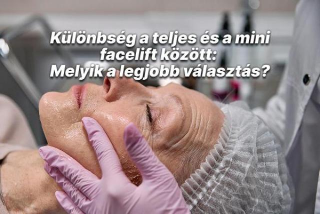 Különbség a teljes és a mini facelift között: Melyik a legjobb választás?