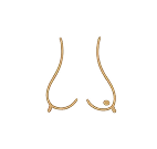 Asymmetry & tuberous breast