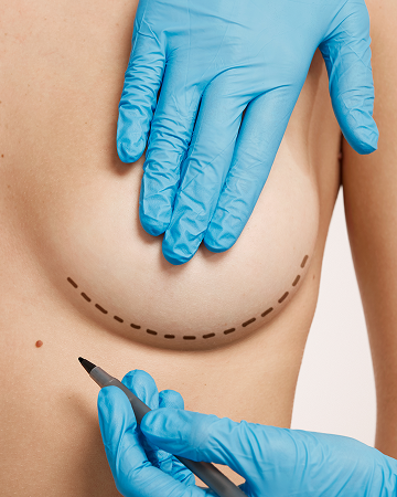 Plasztikai sebészeti kezelés