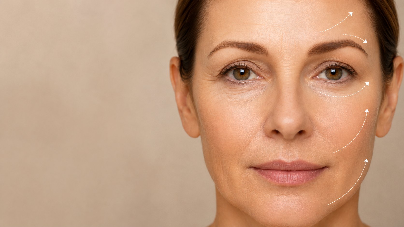Wrinkle Treatments