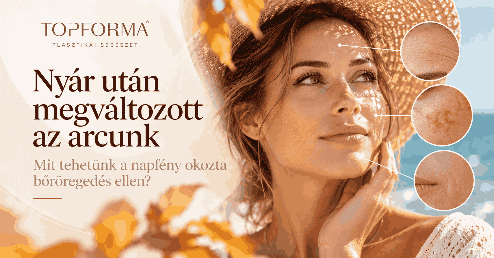 Nyár után megváltozott az arcunk – mit tehetünk a napfény okozta bőröregedés ellen?