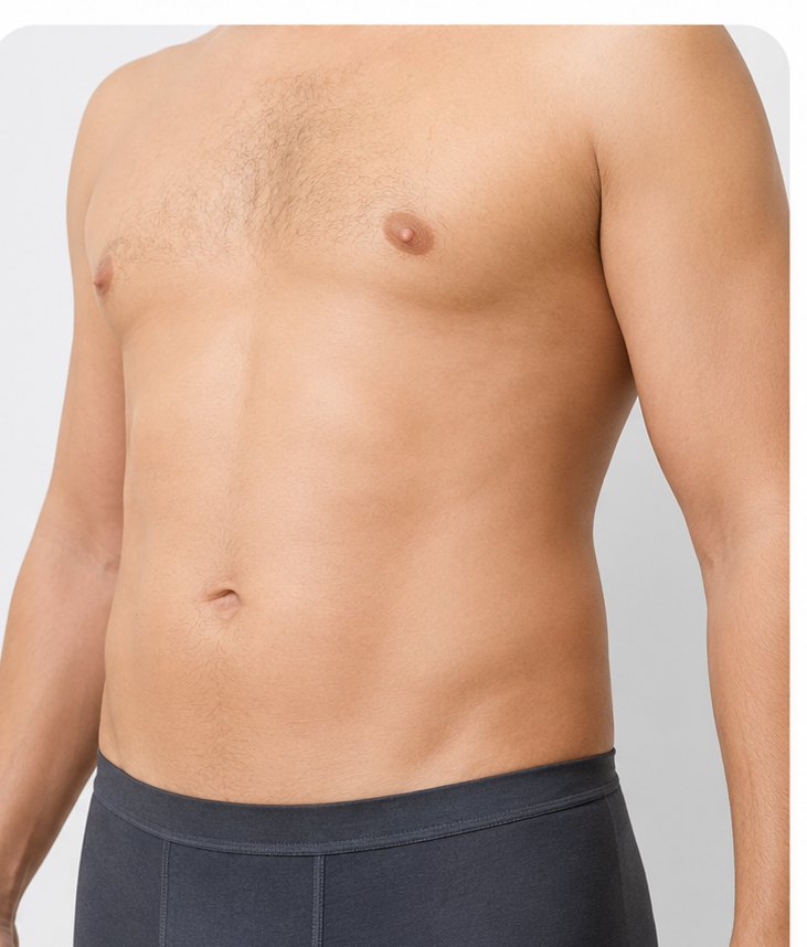 Abdominoplasty – After